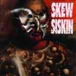 Skew Siskin: "Skew Siskin" – 1992